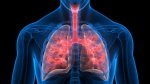 Zatorowość płucna- groźna konsekwencja zakrzepicy żylnej