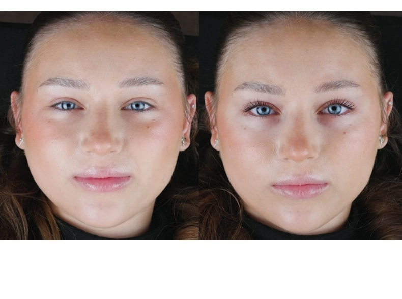 Rarity Lami Hold – Step 2 (5ml)