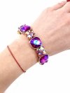 Celebrity Armband Chirurgischer Stahl