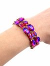 Celebrity Armband Chirurgischer Stahl