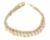 gold bracelet for a gold-plated leg