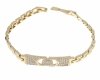 gold bracelet for a gold-plated leg