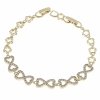 gold bracelet for a gold-plated leg