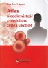 Atlas niedokrwistość z niedoboru żelaza u kobiet