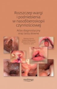 Rozszczep wargi i podniebienia w nasofiberoskopii czynnościowej Atlas diagnostyczny oraz testy słowne