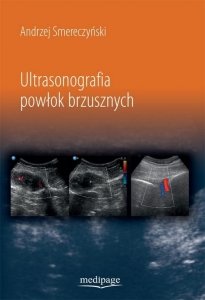Ultrasonografia powłok brzusznych