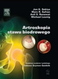 Artroskopia stawu biodrowego z płytą DVD