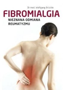 Fibromialgia Nieznana odmiana reumatyzmu
