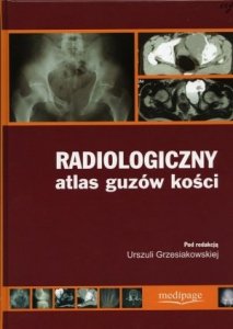Radiologiczny atlas guzów kości