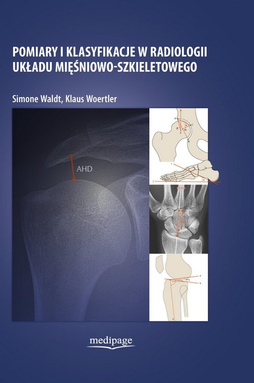 Pomiary i klasyfikacje w radiologii układu mięsniowo-szkieletowego