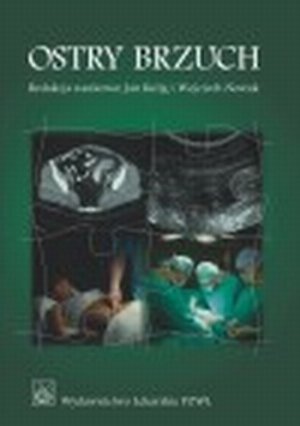 Ostry brzuch Podręcznik dla lekarzy i studentów