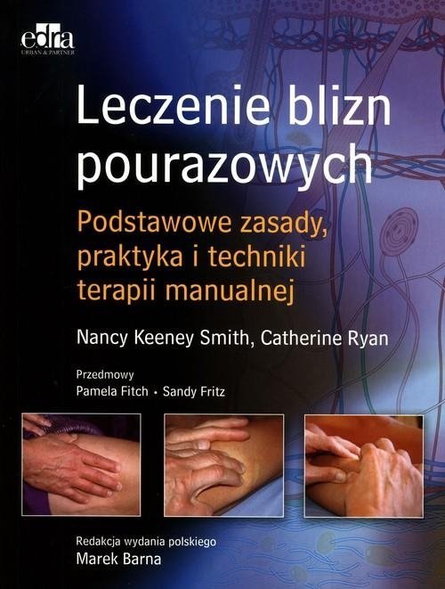 Leczenie blizn pourazowych Podstawowe zasady praktyka i techniki terapii manualnej