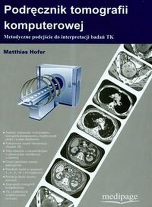 Podręcznik tomografii komputerowej Metodyczne podejście do interpretacji badań TK