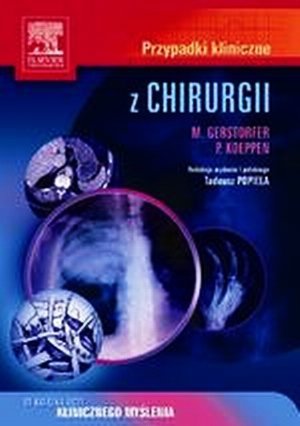 Przypadki kliniczne z chirurgii Seria Przypadki Kliniczne