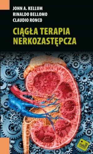 Ciągła terapia nerkozastępcza