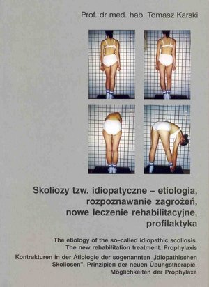 Skoliozy tzw idiopatyczne etiologia rozpoznawanie zagrożeń..