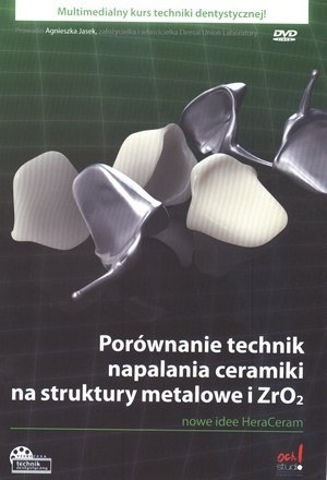 Porównanie technik napalania ceramiki na struktury metalowe DVD