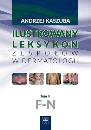 Ilustrowany leksykon zespołów w dermatologii Tom 2 F N