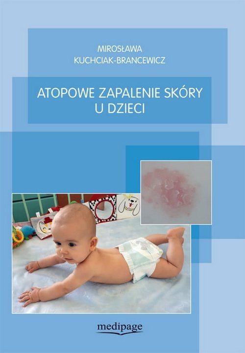 Atopowe zapalenie skóry u dzieci