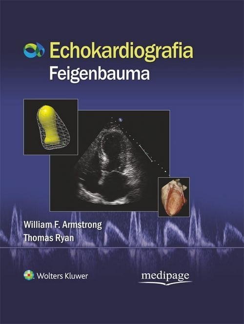 Echokardiografia Feigenbauma