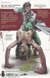 WITCH DOCTOR VOL 01 UNDER THE KNIFE TP [9781607064411] **promocja TOMY**