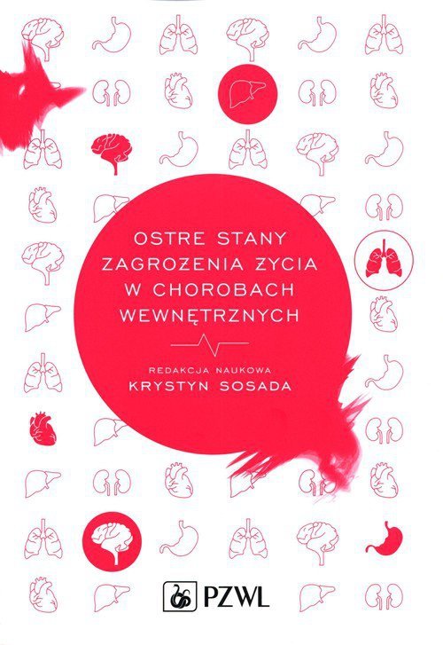 Ostre stany zagrożenia życia w chorobach wewnętrznych