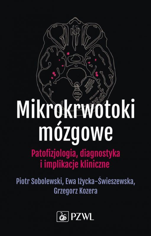 Mikrokrwotoki mózgowe. Patofizjologia, diagnostyka i implikacje kliniczne