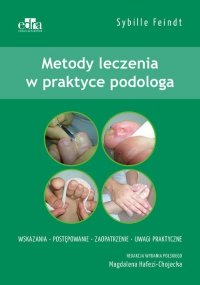 Metody leczenia w praktyce podologa 