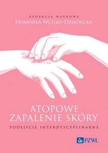 Atopowe zapalenie skóry Podejście interdyscyplinarne 