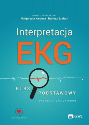 Interpretacja EKG