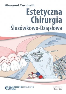 Estetyczna chirurgia śluzówkowo-dziąsłowa