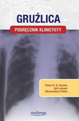 Gruźlica - Podręcznik klinicysty 