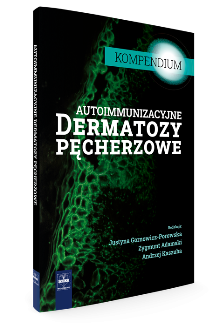 Autoimmunizacyjne dermatozy pęcherzowe