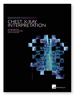 CHEST X-RAY Interpretation, Discover Radiology