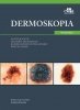 Dermoskopia 
