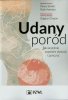 Udany poród 