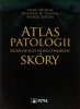 Atlas patologii złośliwych nowotworów skóry 