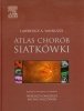 Atlas chorób siatkówki 