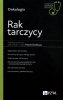 Rak tarczycy 