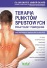 Terapia punktów spustowych 