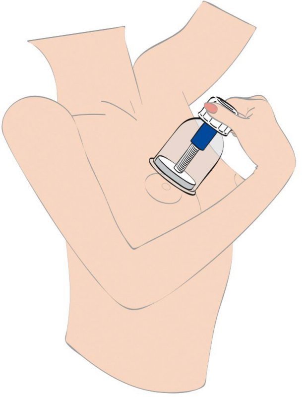 Max twist nipple sucker XL