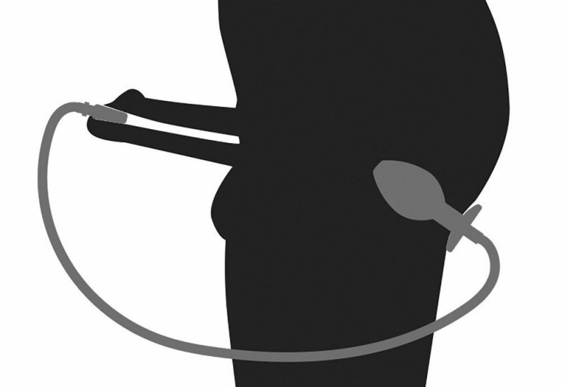 Dilator z przewodem i korkiem analnym do sikania w pupę
