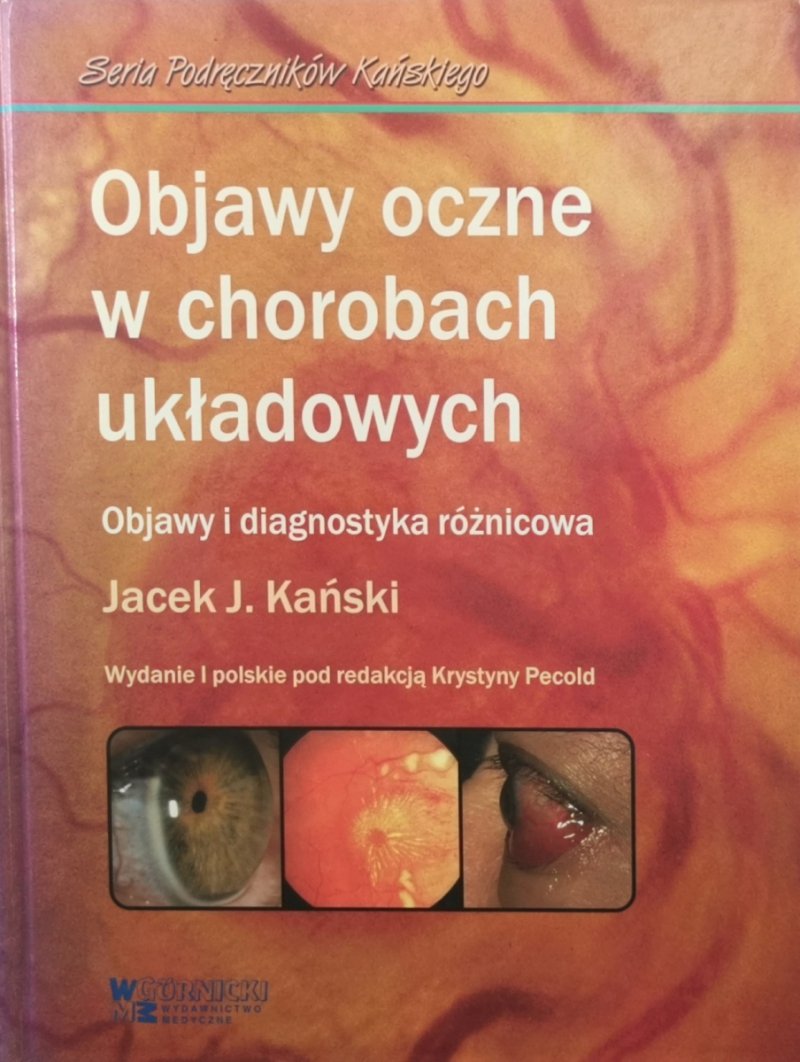 OBJAWY OCZNE W CHOROBACH UKŁADOWYCH  - Jacek J. Kański
