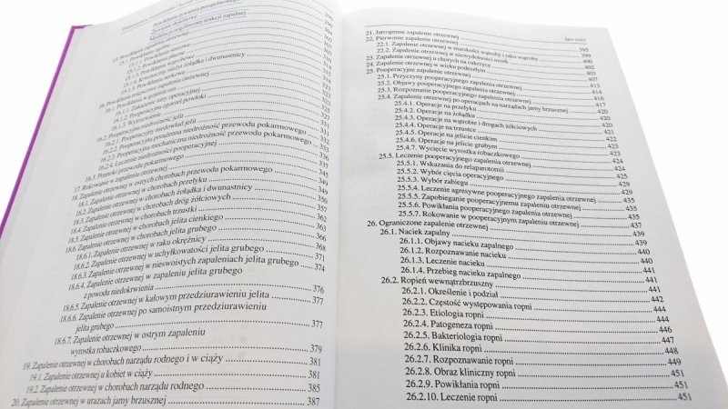 OTRZEWNA ETIOPATOGENEZA ROZPOZNAWANIE...Ciesielski