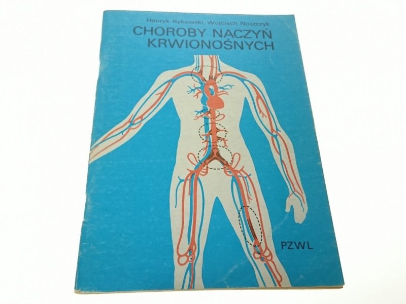 CHOROBY NACZYŃ KRWIONOŚNYCH - Rynkowski (1985)