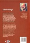 Udar mózgu