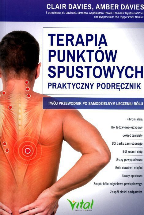 Terapia punktów spustowych